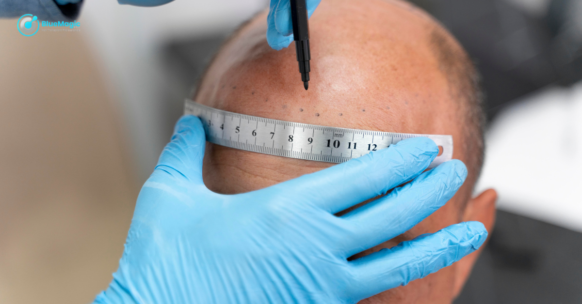 Advanced Hair Transplant Techniques in Dubai