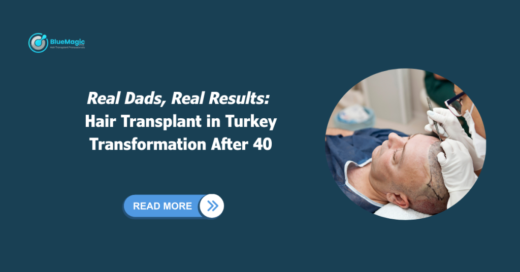 Hair transplant in Turkey after 40