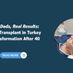 Hair transplant in Turkey after 40