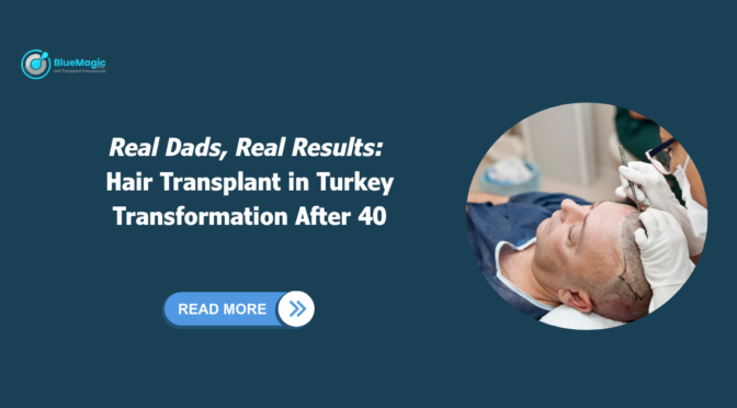 Hair transplant in Turkey after 40