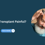 Hair Transplant in Turkey