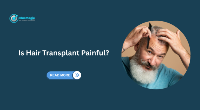 Hair Transplant in Turkey