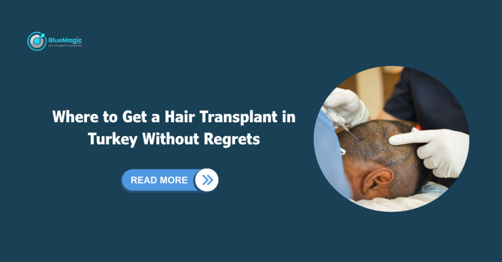 Where to Get a Hair Transplant in Turkey Without Regrets