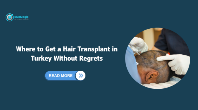Hair Transplant in Turkey