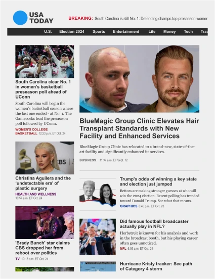 Slide showcasing patient testimonials and success stories from BlueMagic Group's hair transplant procedures.