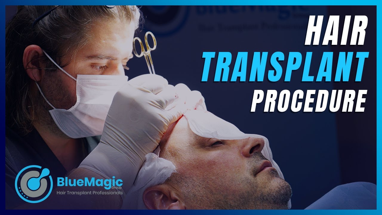 Hair Transplant Procedure