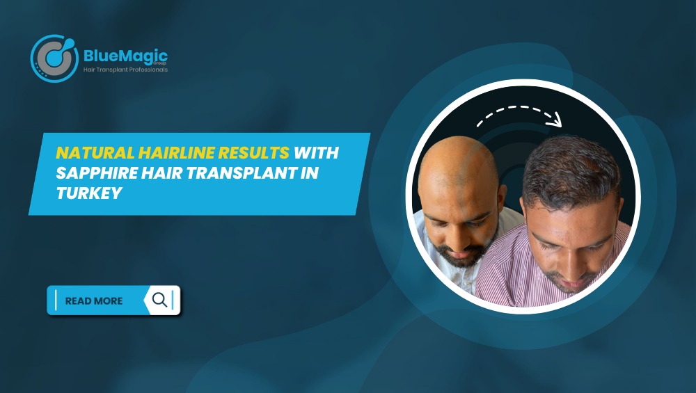 sapphire hair transplant Turkey