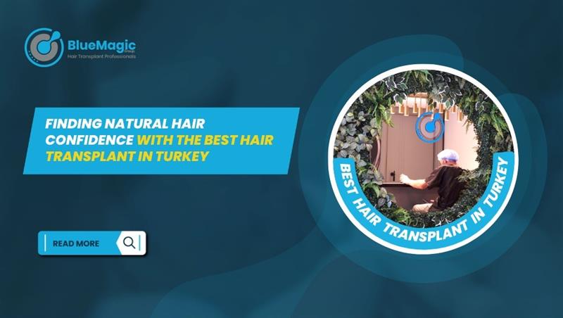 best hair transplant in Turkey